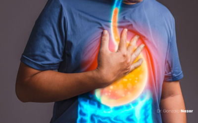 Reflujo gastro-esofágico y su impacto en Otorrinolaringología