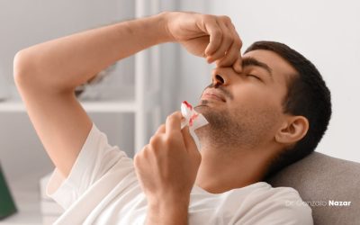 SANGRADO DE NARIZ O EPISTAXIS